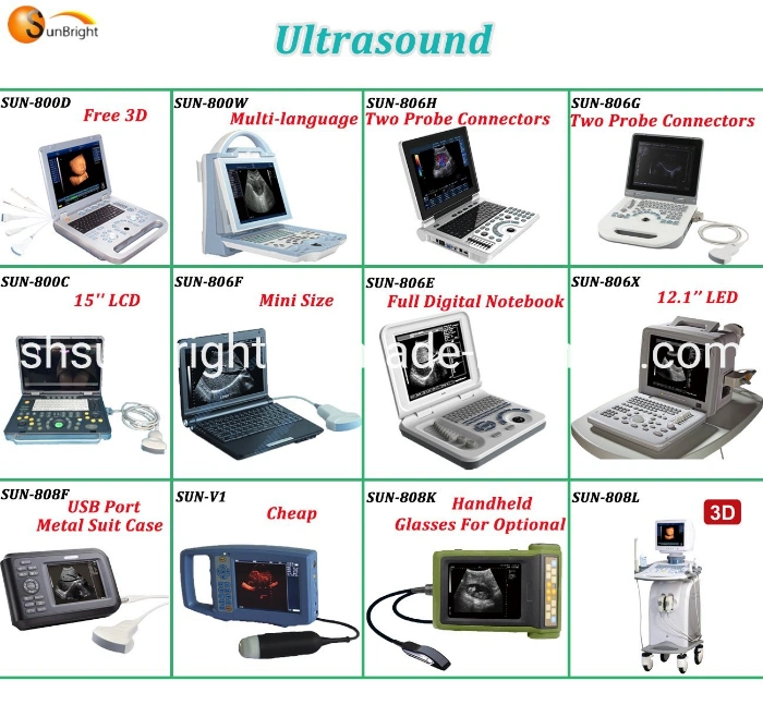 15" LED 3D Ob Gyn Obstetrics Trolley Ultrasound Machine 3D Trolley Ultrasound Device